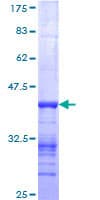 Human NEB / Nebulin Protein (Recombinant GST, N-terminus)