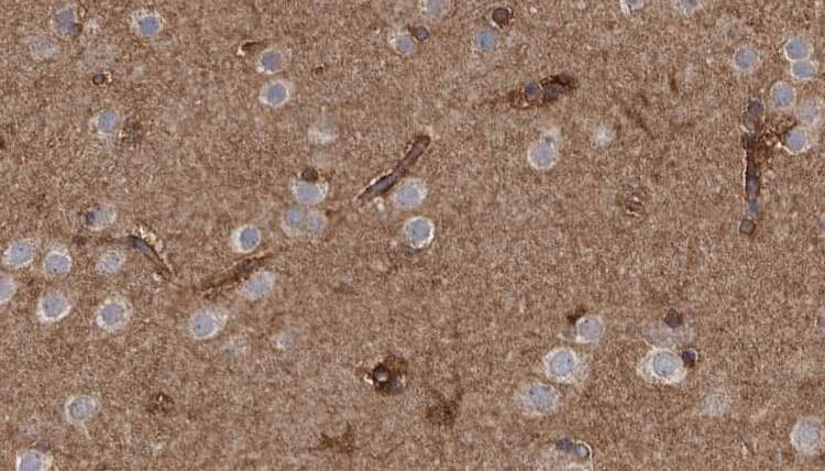 CD66d / CEACAM3 Antibody