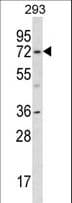 KCND1 / Kv4.1 Antibody (aa118-147)