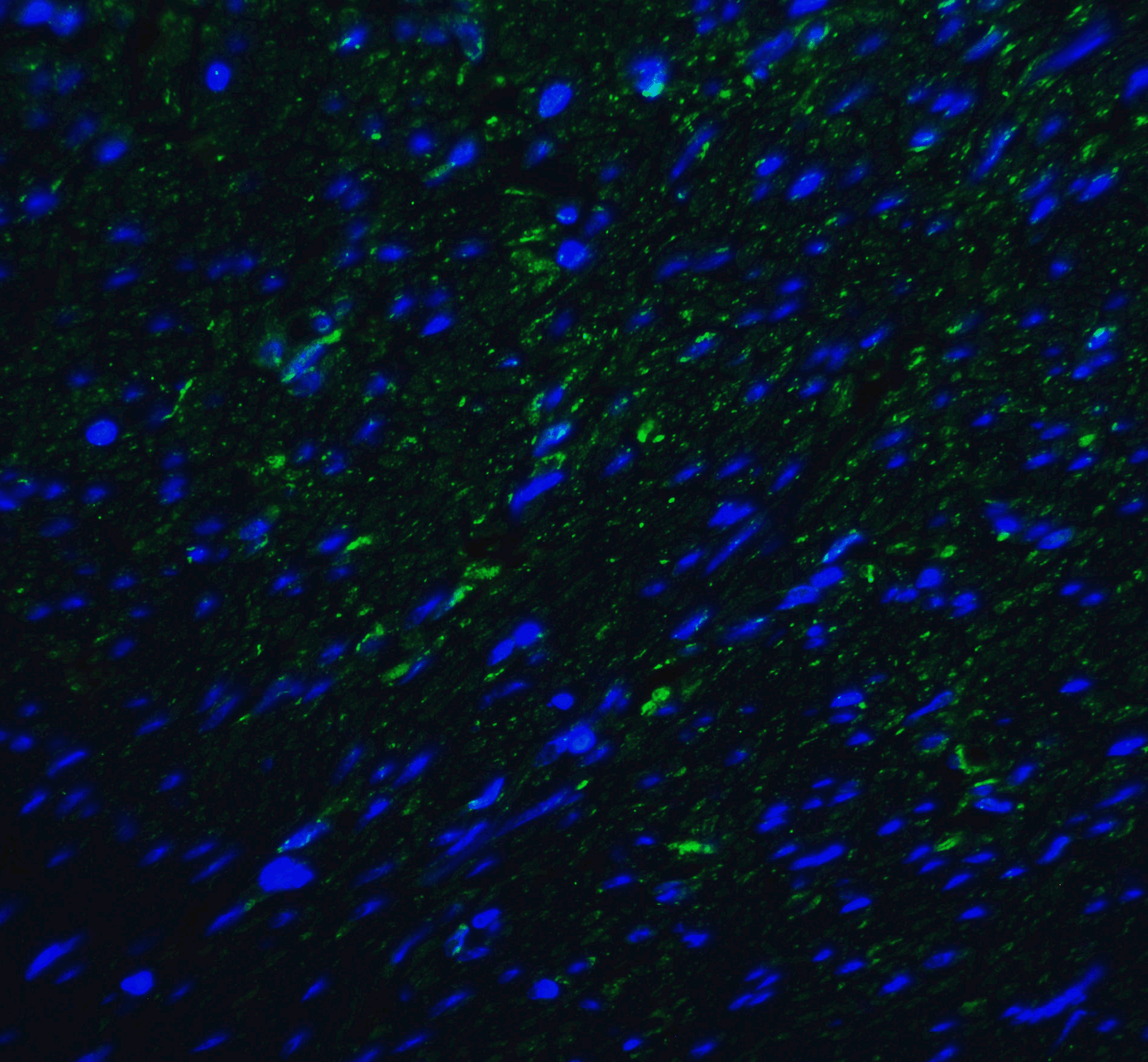 PathPlus™ TMIGD2 Antibody (clone 8G1)