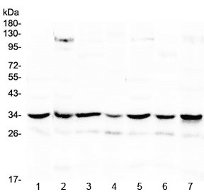 UCP2 Antibody