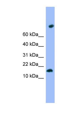 Polyclonal Rabbit anti-Human TMEM42 Antibody (N-Terminus, WB)