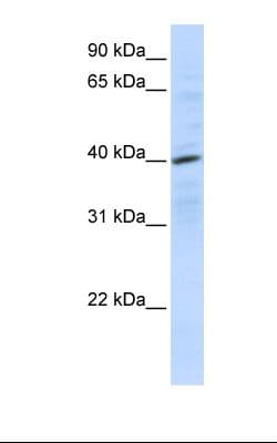 CXCR4 Antibody (N-Terminus)