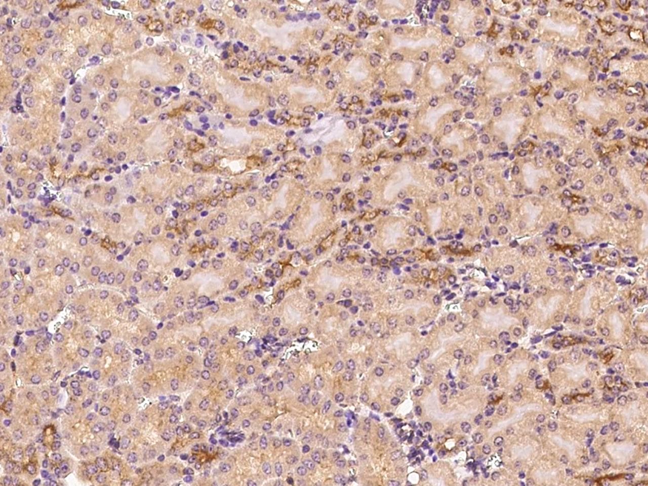 Polyclonal Rabbit anti-Human ARF3 Antibody (IHC)