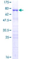 Human GKAP1 Protein (Recombinant GST)