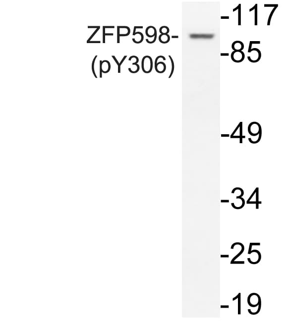 Polyclonal Rabbit anti-Human ZNF598 Antibody (phospho-Tyr306, WB)