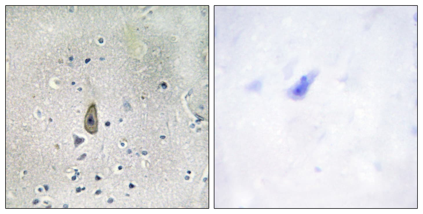 KCNJ1 / ROMK Antibody (phospho-Ser44/Ser25)