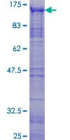 Human MYBL2 Protein (Recombinant GST)