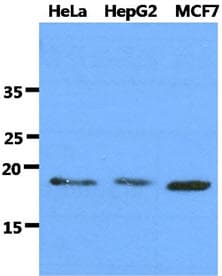 Monoclonal Mouse anti-Human DNAL1 Antibody (clone AT29E4, WB)