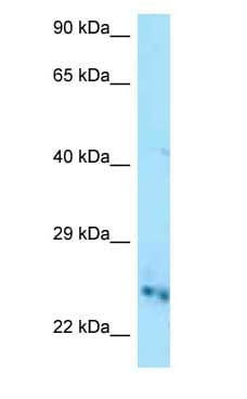 CMPK / CMPK1 Antibody (aa152-201)