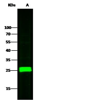 SOD2 / Mn SOD Antibody (Preservative Free)