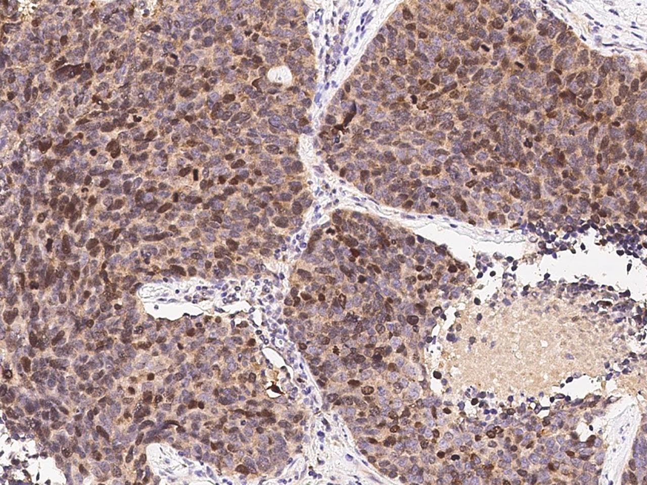 BIRC5 / Survivin Antibody (Preservative Free)