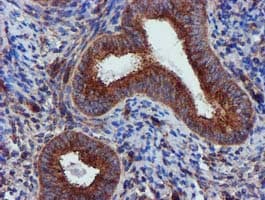EPN2 Antibody (clone OTI1F1)