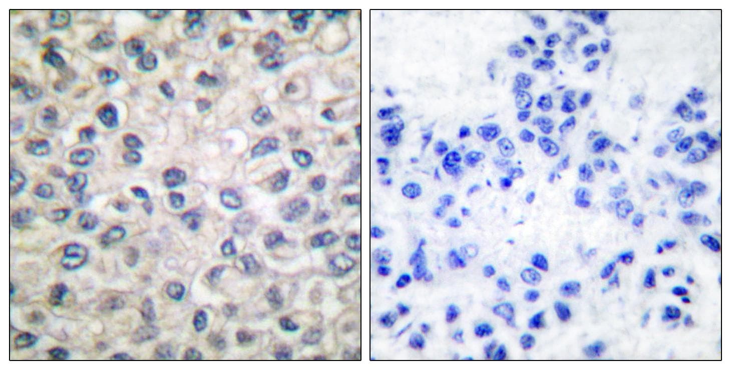 CTNNA1 / Catenin Alpha-1 Antibody