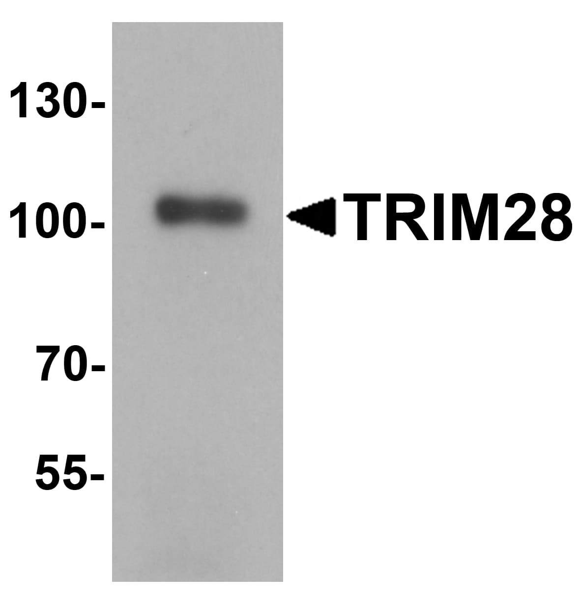 IHC-plus™ TRIM28 / KAP1 Antibody