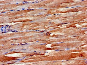 Polyclonal Rabbit anti-Human FBXW2 Antibody