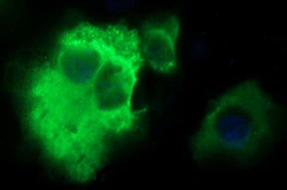 PLA2G16 / HRASLS3 Antibody (clone OTI1C9)