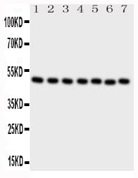 Polyclonal Rabbit anti-Human CTBP2 Antibody (aa429-445, IHC, WB)