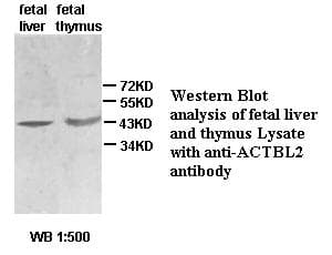 IHC-plus™ ACTBL2 Antibody