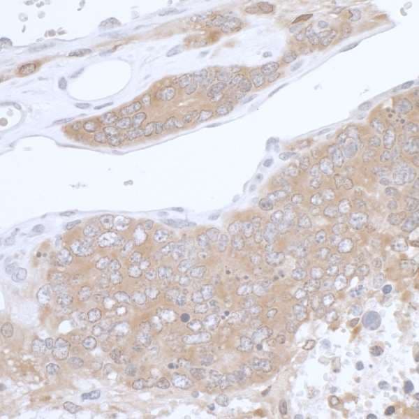 PHGDH Antibody (aa1-50)
