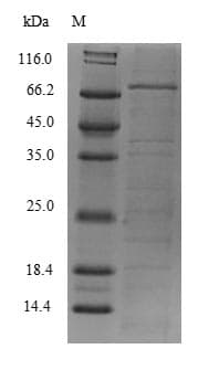 Human REXO4 / MPMC2 Protein (Recombinant 6His-SUMO, N-terminus)