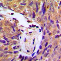 Polyclonal Rabbit anti-Human IKK Alpha+Beta Antibody (phospho-Ser180/Ser181, IHC, WB)