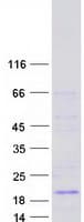 Human MRLC2 / MYL12B Protein (Recombinant Myc-DDK (Flag))