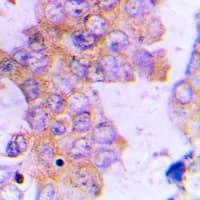 ACAT1 Antibody (Internal)