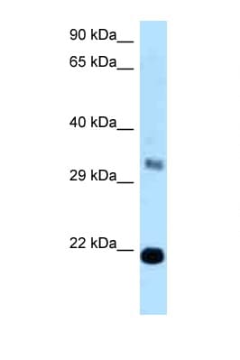 Polyclonal Rabbit anti-Human FKBP14 Antibody (C-Terminus, WB)
