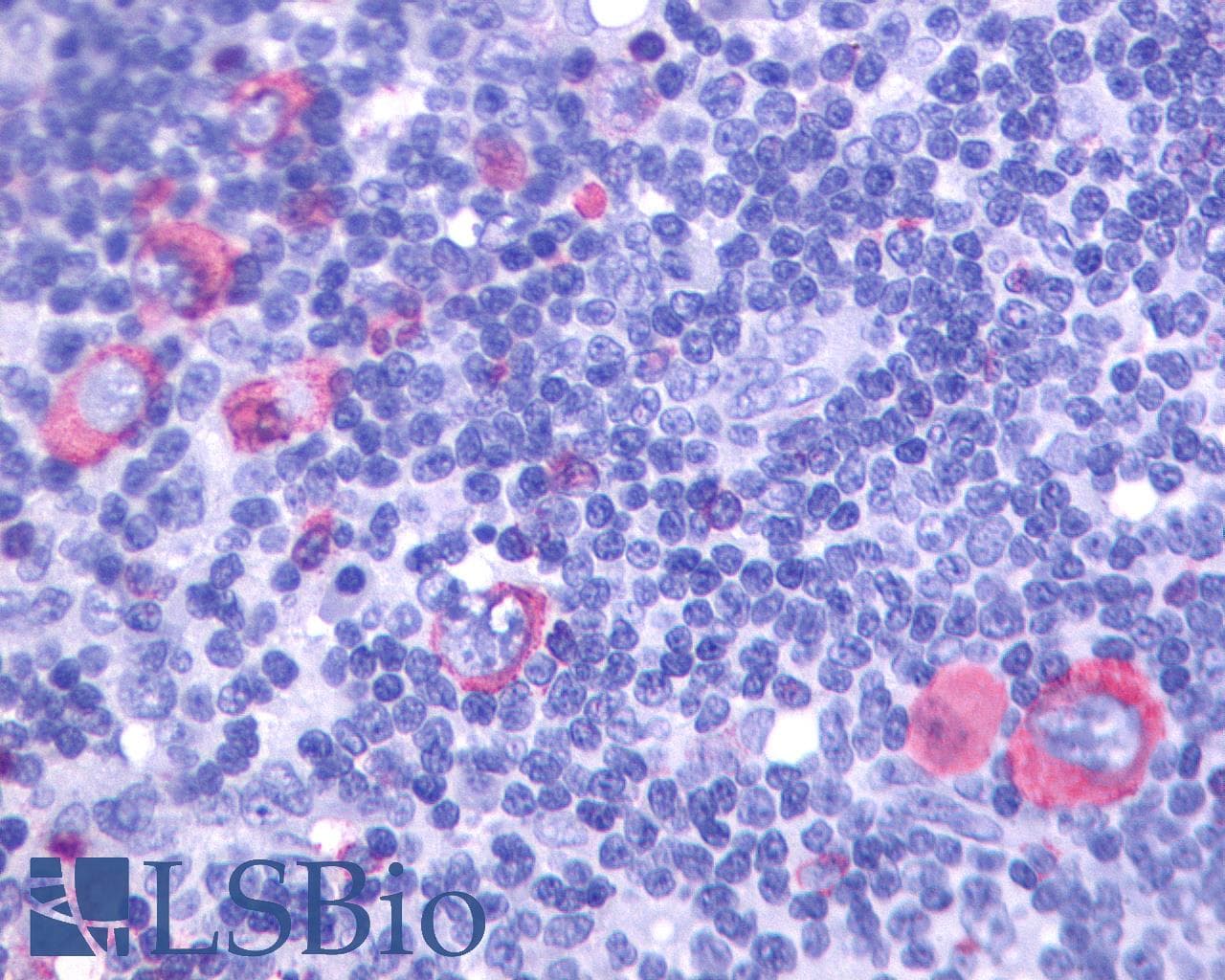 IHC-plus™ Polyclonal Rabbit anti-Human GPR137 Antibody (Extracellular Domain, IHC)