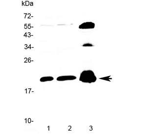 Polyclonal Rabbit anti-Human PPP1R14A / CPI-17 Antibody (IHC, WB)