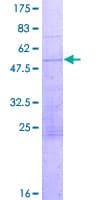 Human CCDC88B Protein (Recombinant GST)