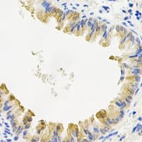 COQ7 Antibody