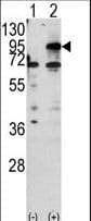 CPT1B Antibody (aa606-637)