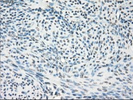 Monoclonal Mouse anti-Human GBP2 Antibody (clone OTI5E10, IHC, WB)