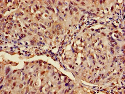 ATXN3 / JOS Antibody (aa1-288)