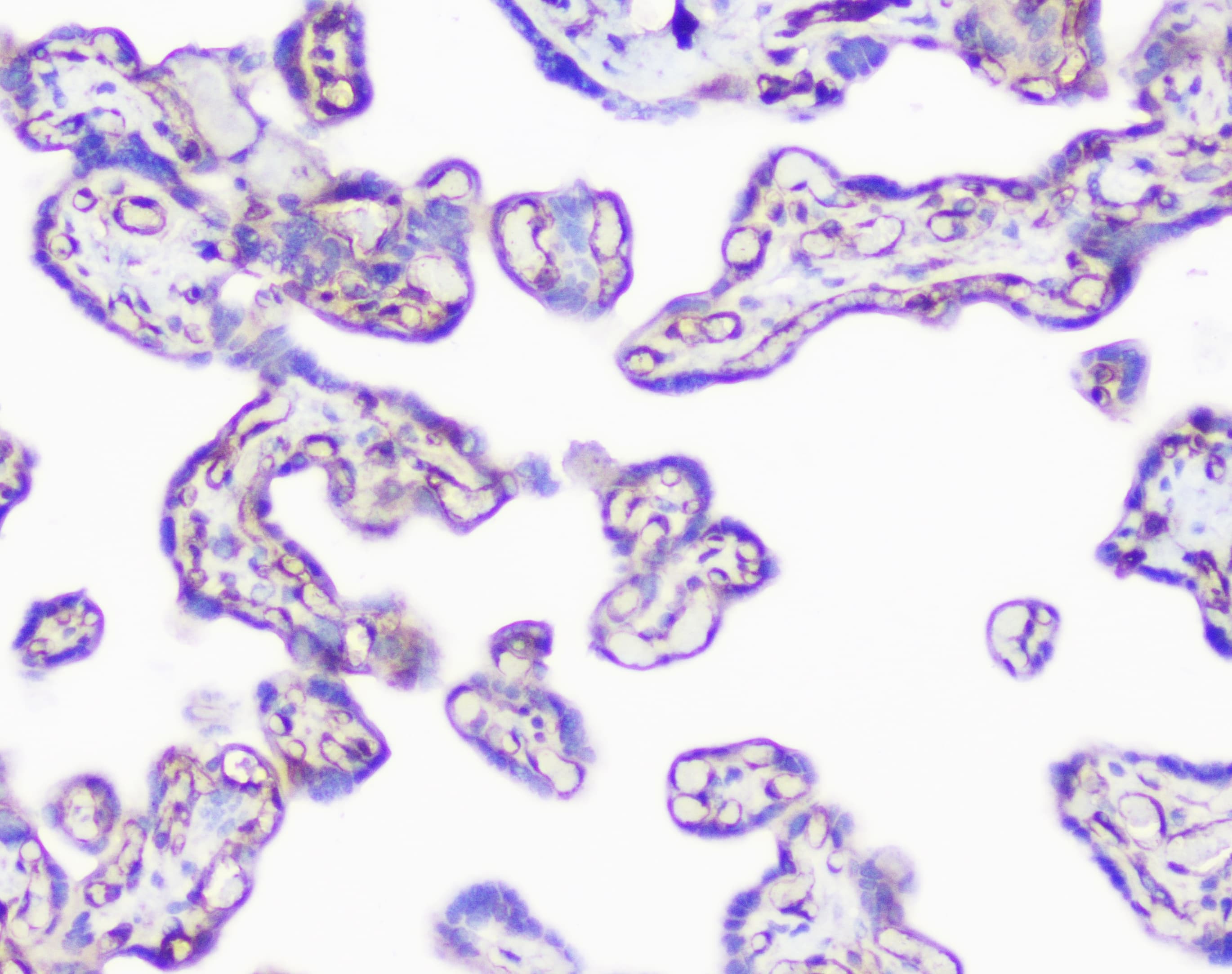 Polyclonal Rabbit anti-Human INPPL1 / SHIP2 Antibody (IHC, WB)