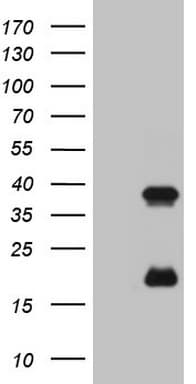 Monoclonal Mouse anti-Human KLK3 / PSA Antibody (clone OTI3A11, aa25-261, IHC, WB)