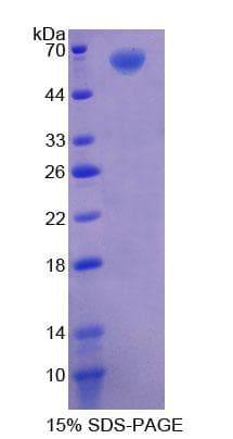 Human AGK Protein (Recombinant His-GST)