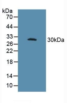 FCGR3A / CD16A Antibody (aa26-108)