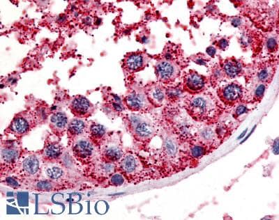 IHC-plus™ Polyclonal Rabbit anti-Human MC5R / MC5 Receptor Antibody (N-Terminus, IHC)