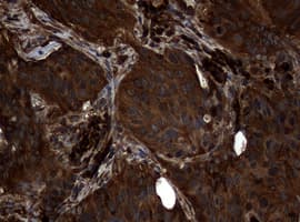 NME1 / NM23 Antibody (clone OTI6E8)