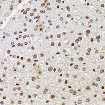 CDX2 Antibody
