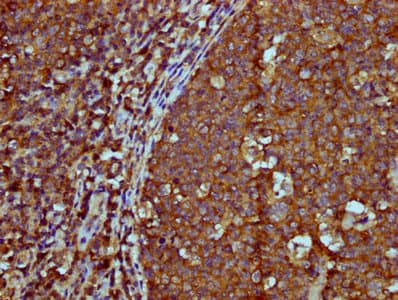 IGHM / IgM Antibody