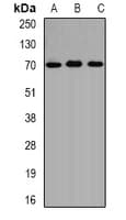 Polyclonal Rabbit anti-Human ALAS1 Antibody (IF, WB)