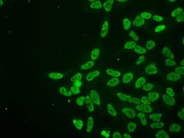 PRKY Antibody (clone OTI3E10, Carrier-free)