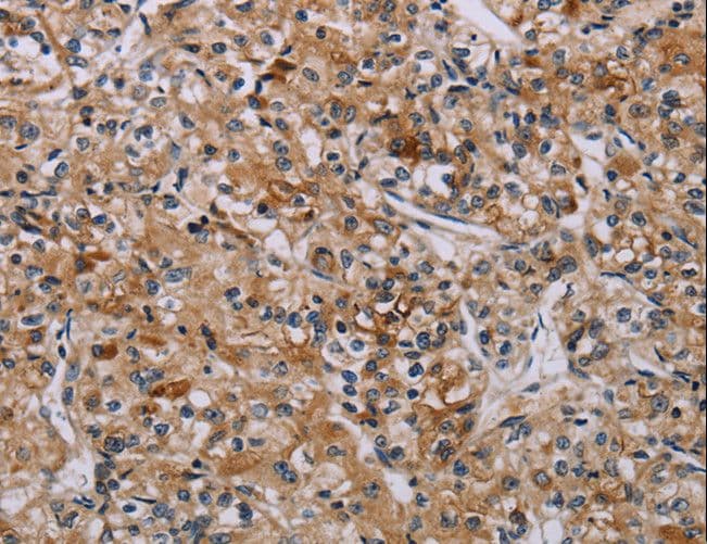Polyclonal Rabbit anti-Human AATK / AATYK Antibody (IHC)
