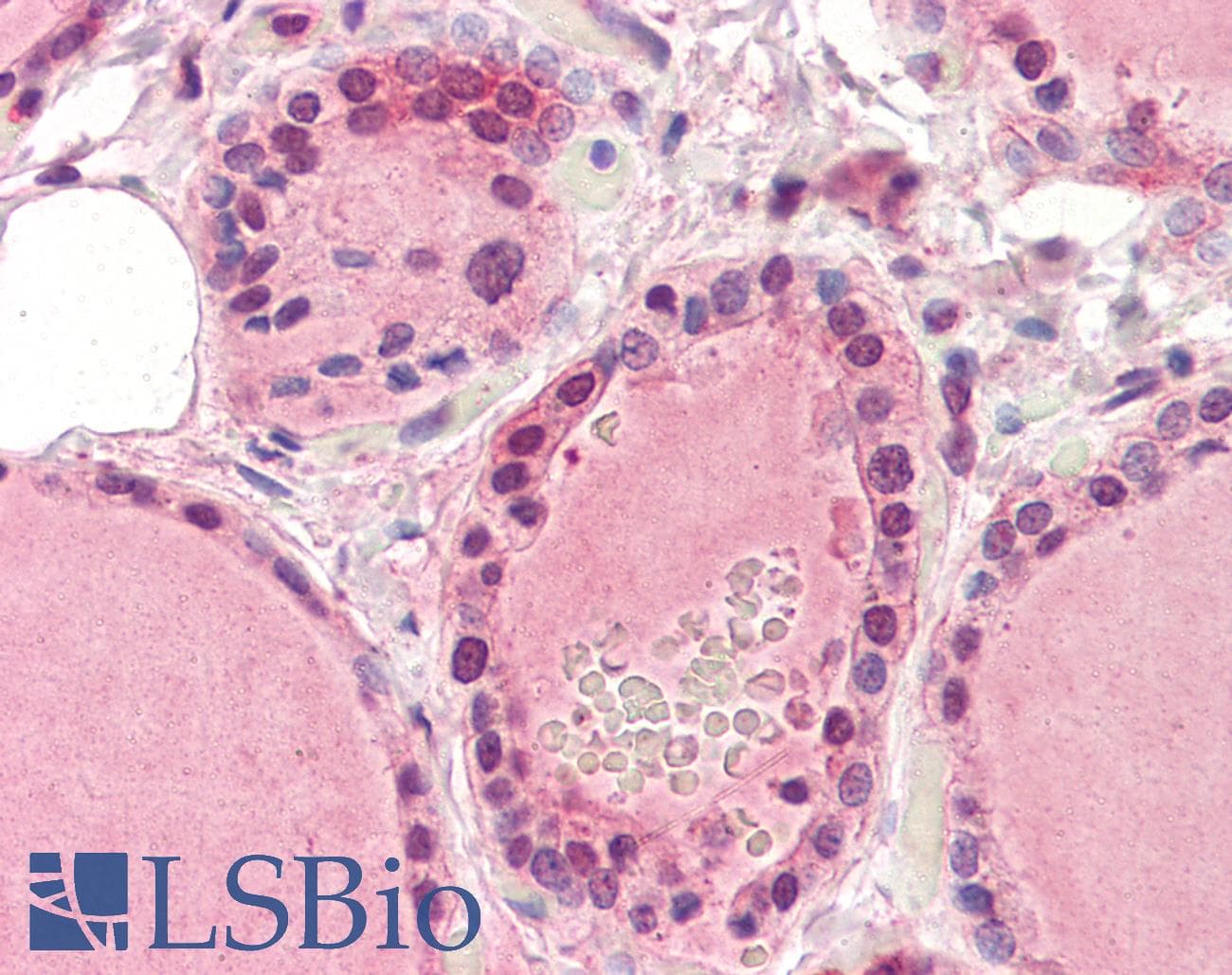 IHC-plus™ EPHA2 / EPH Receptor A2 Antibody (aa559-976, clone 3D7)