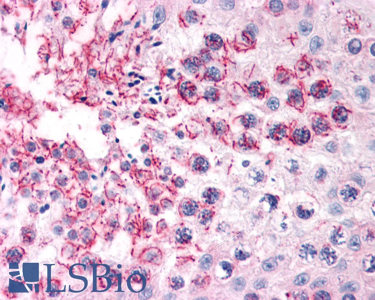 IHC-plus™ TFF2 / SP Antibody (Internal)