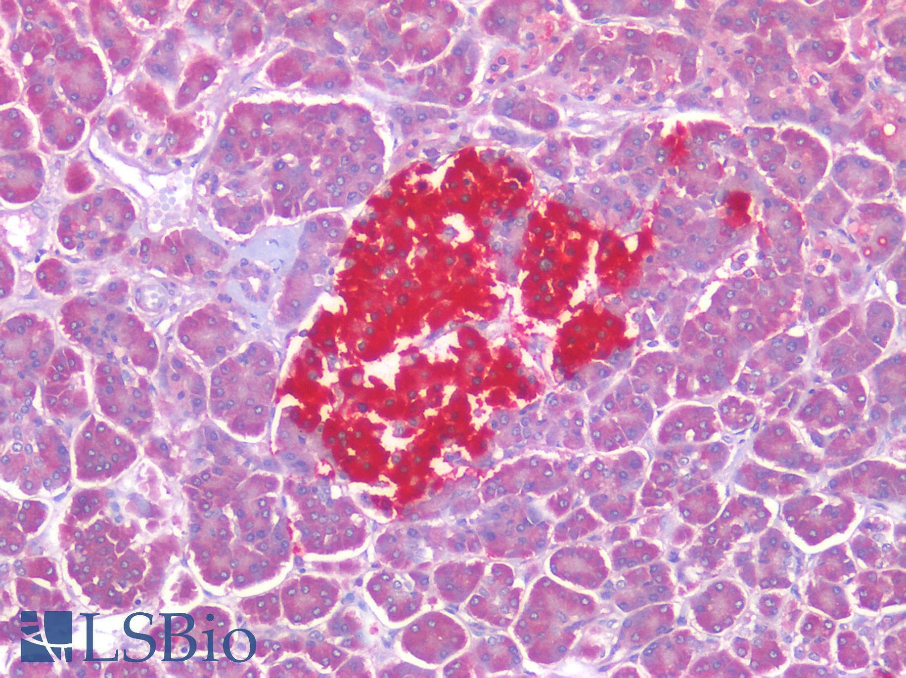 IHC-plus™ AGTR2 / AT2 Receptor Antibody (Internal)